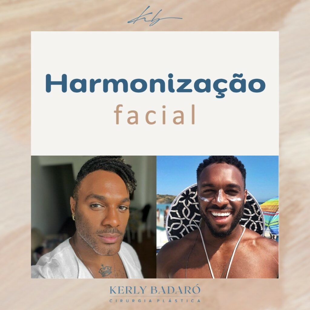 Harmonização Facial